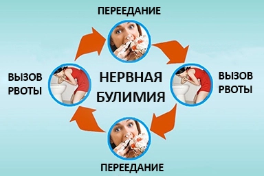 Лечение булимии в Марьянской